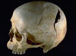 Skull showing head wound